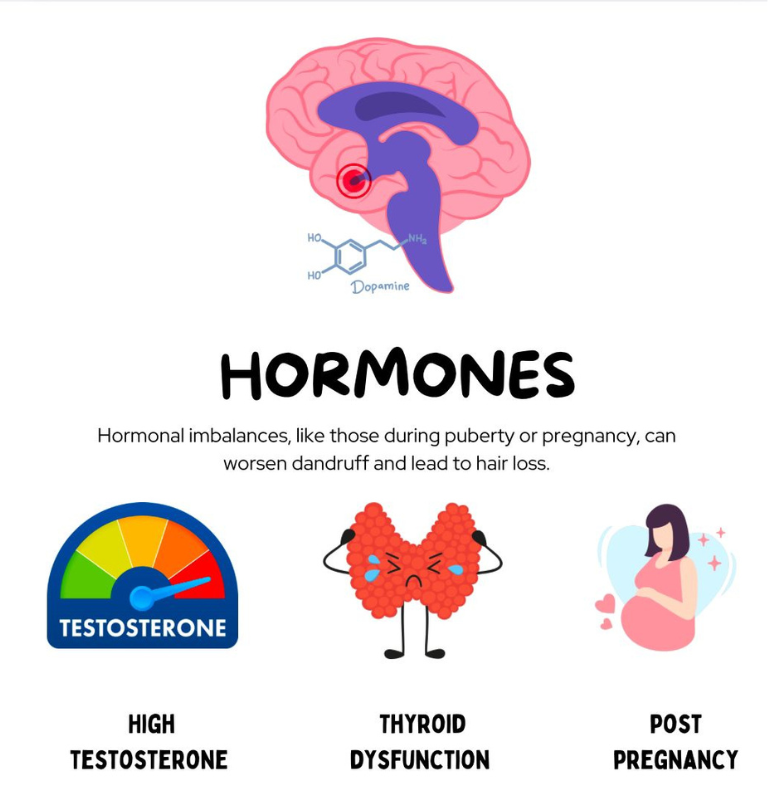 What Causes  Hair-fall