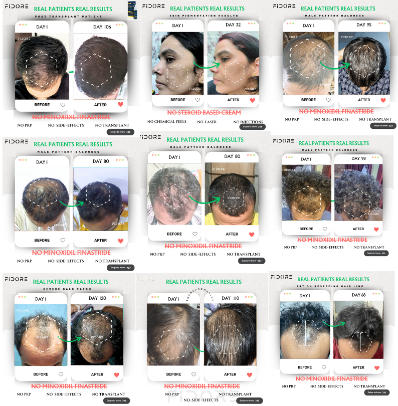 If they can , Why  Cant you ?