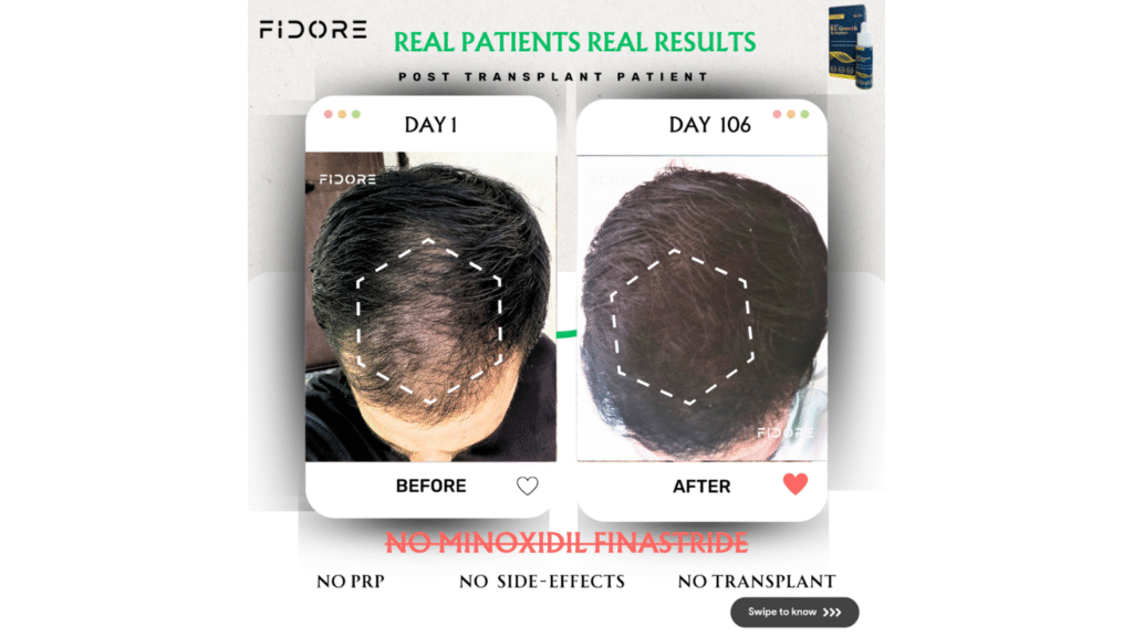 If they can , Why  Cant you ? - details