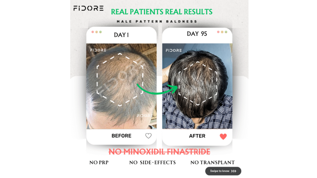 If they can , Why  Cant you ? - details