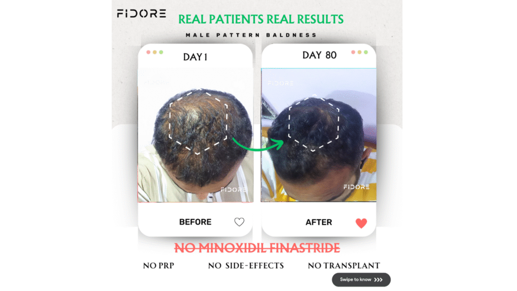 If they can , Why  Cant you ? - details