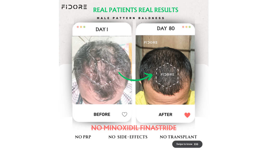 If they can , Why  Cant you ? - details