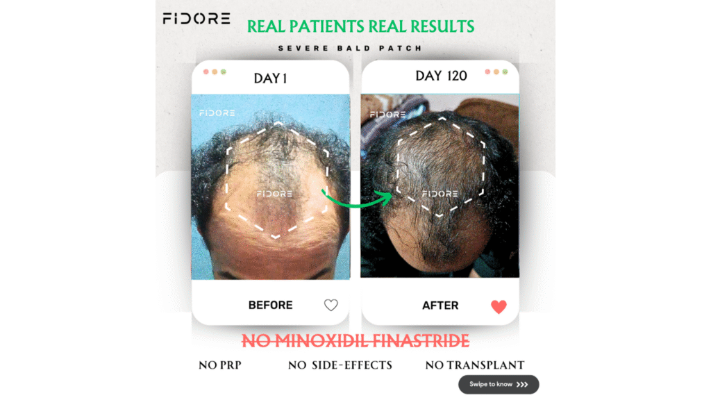 If they can , Why  Cant you ? - details