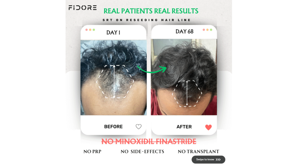 If they can , Why  Cant you ? - details