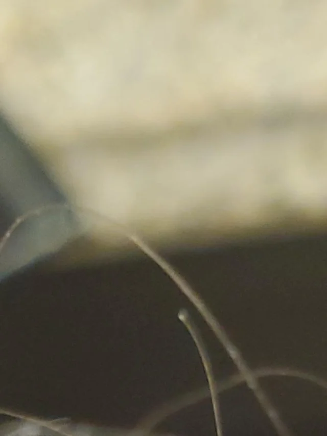 Shedding hair with a  Root bulb ?