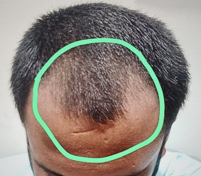 Before