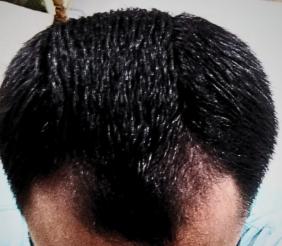 After