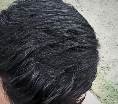 After