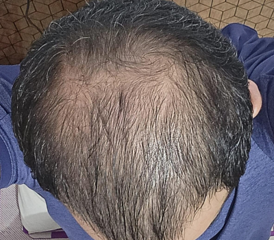 Before