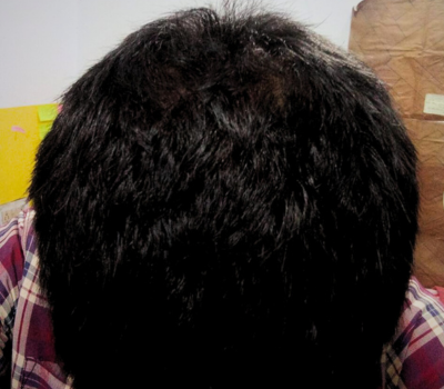 After