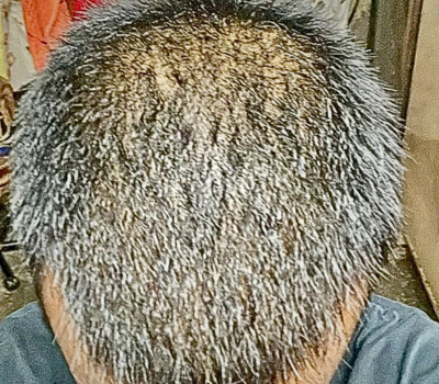 Before