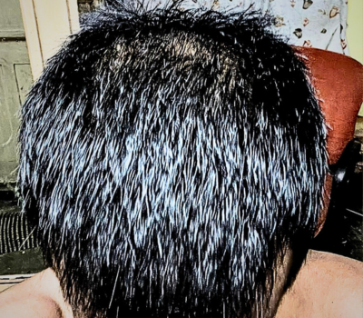 After