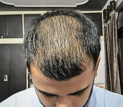 Before