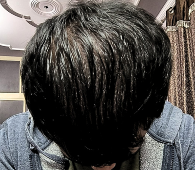 After