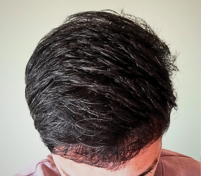 After