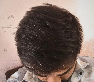 Before
