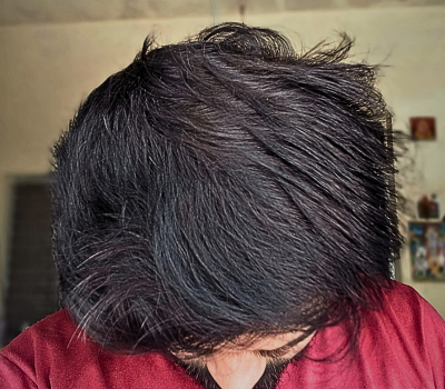 After
