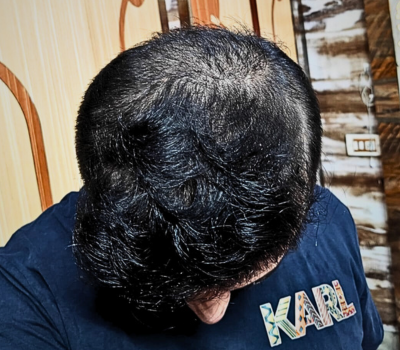 After
