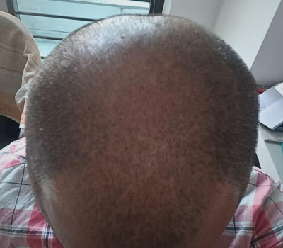 Before