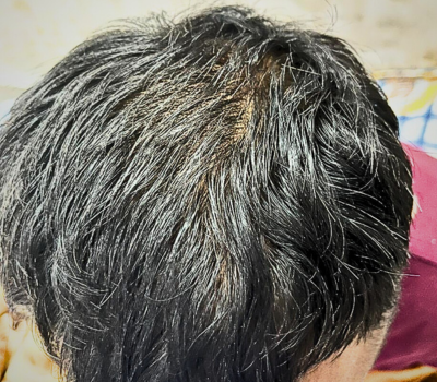 After