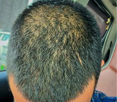 Before