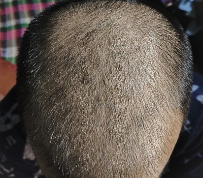 Before