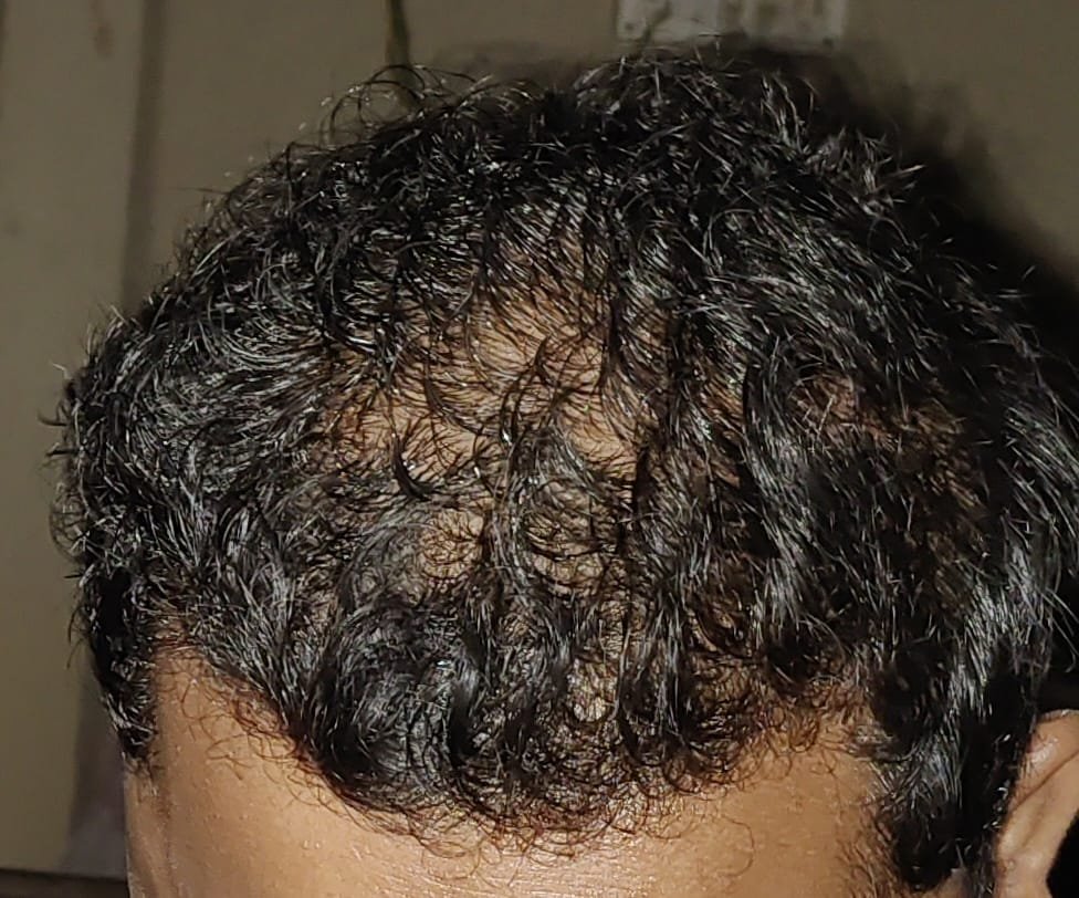 After