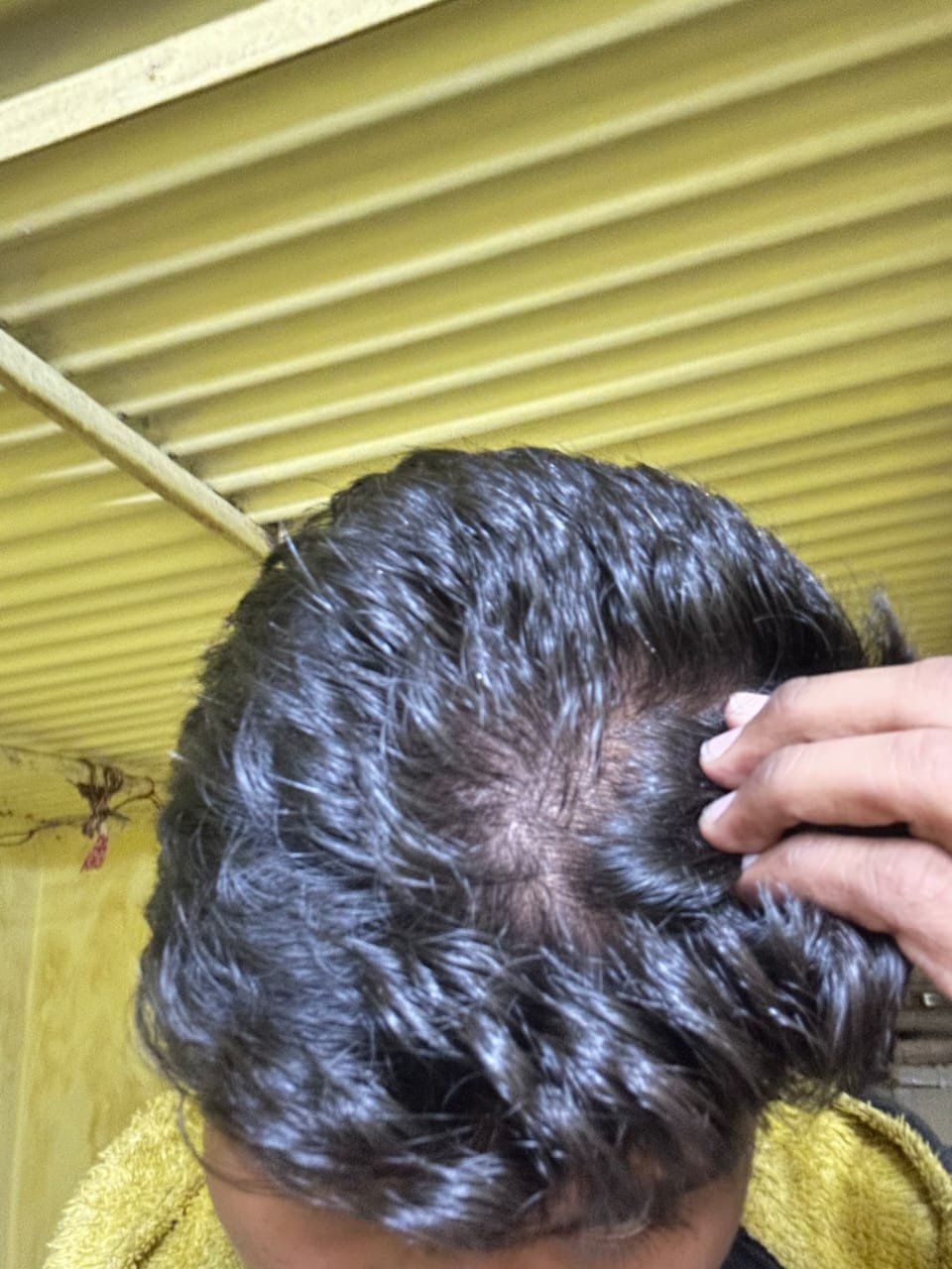 Before