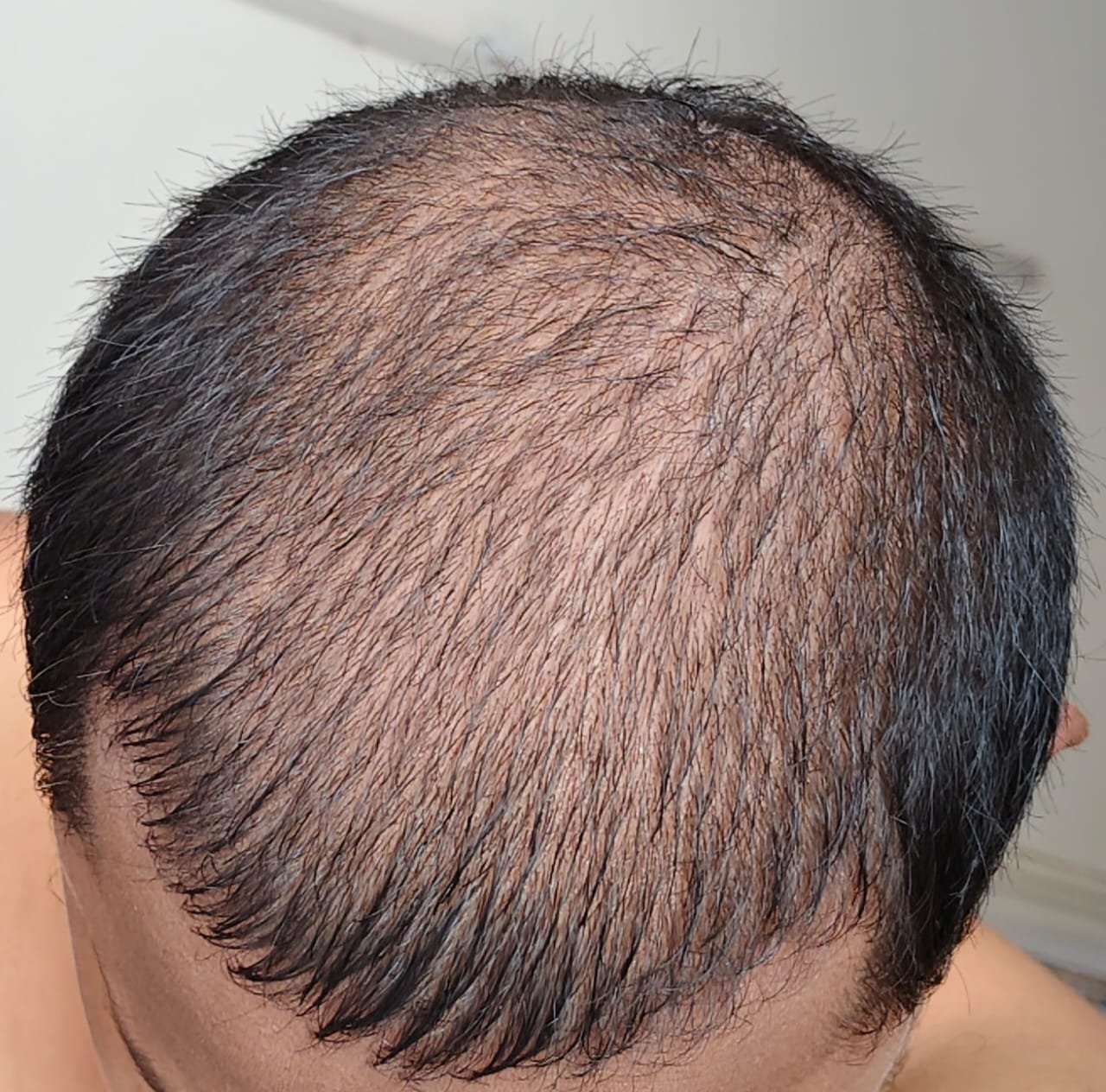 Before
