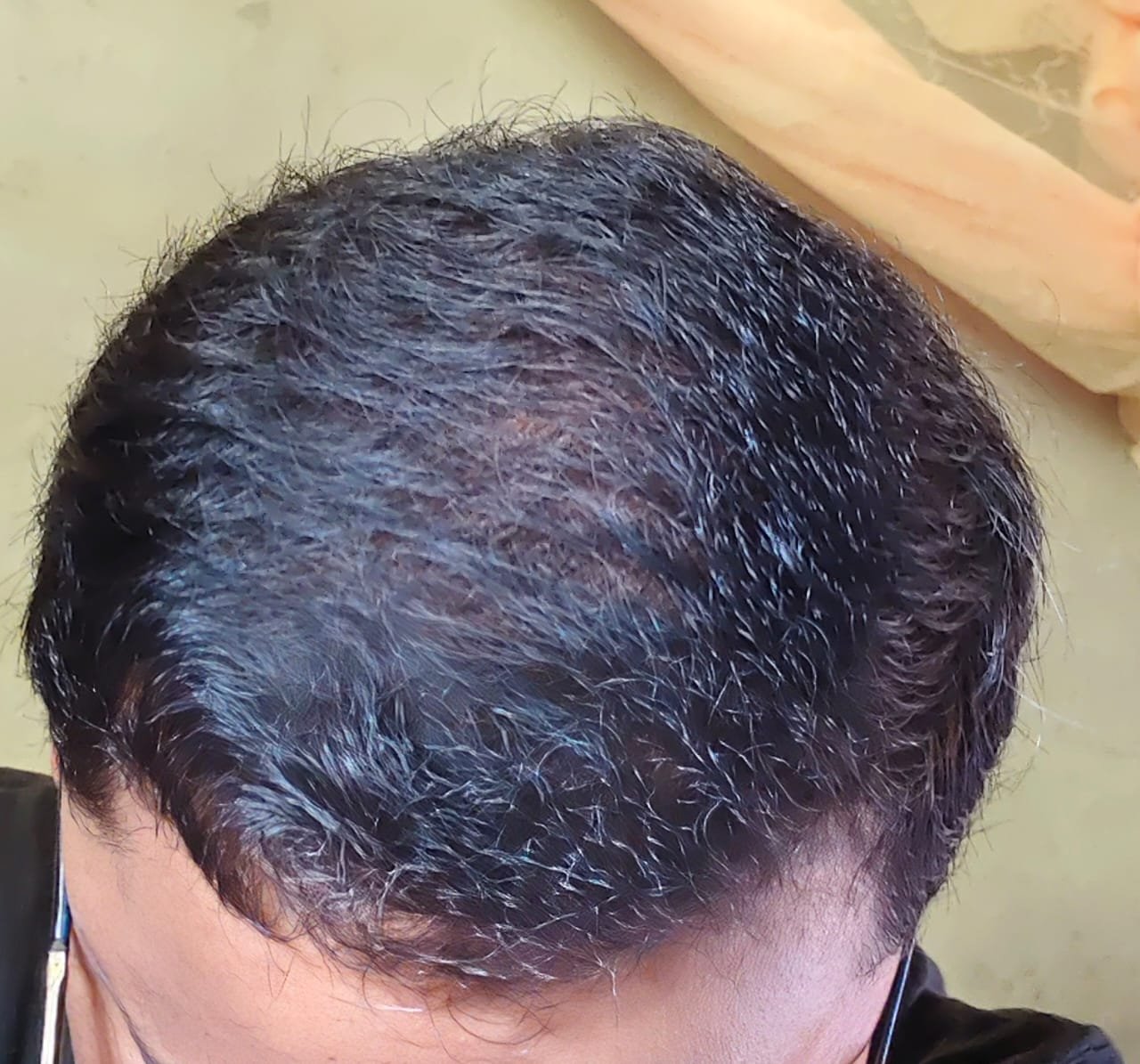 After