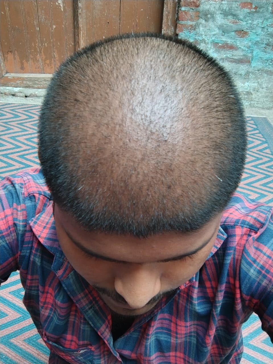 Before