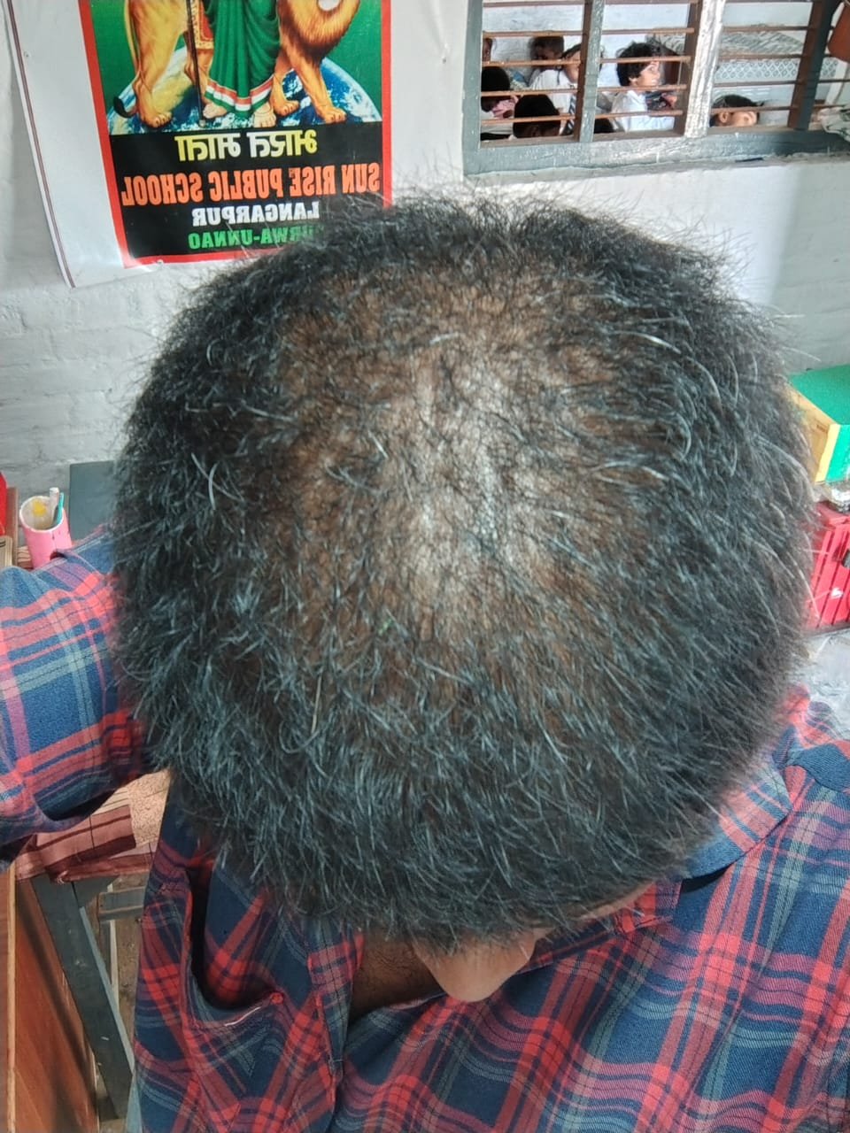 After