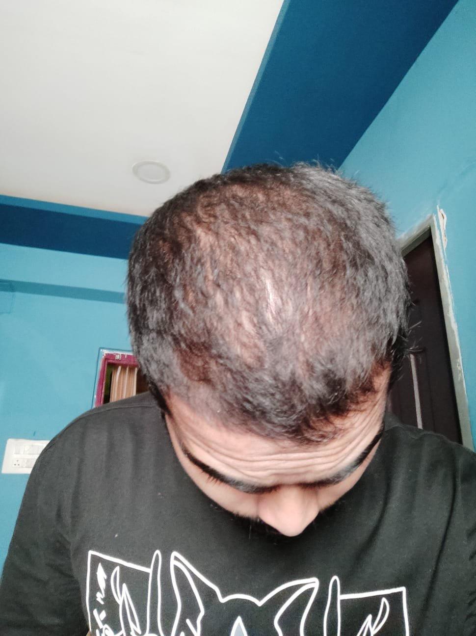 Before