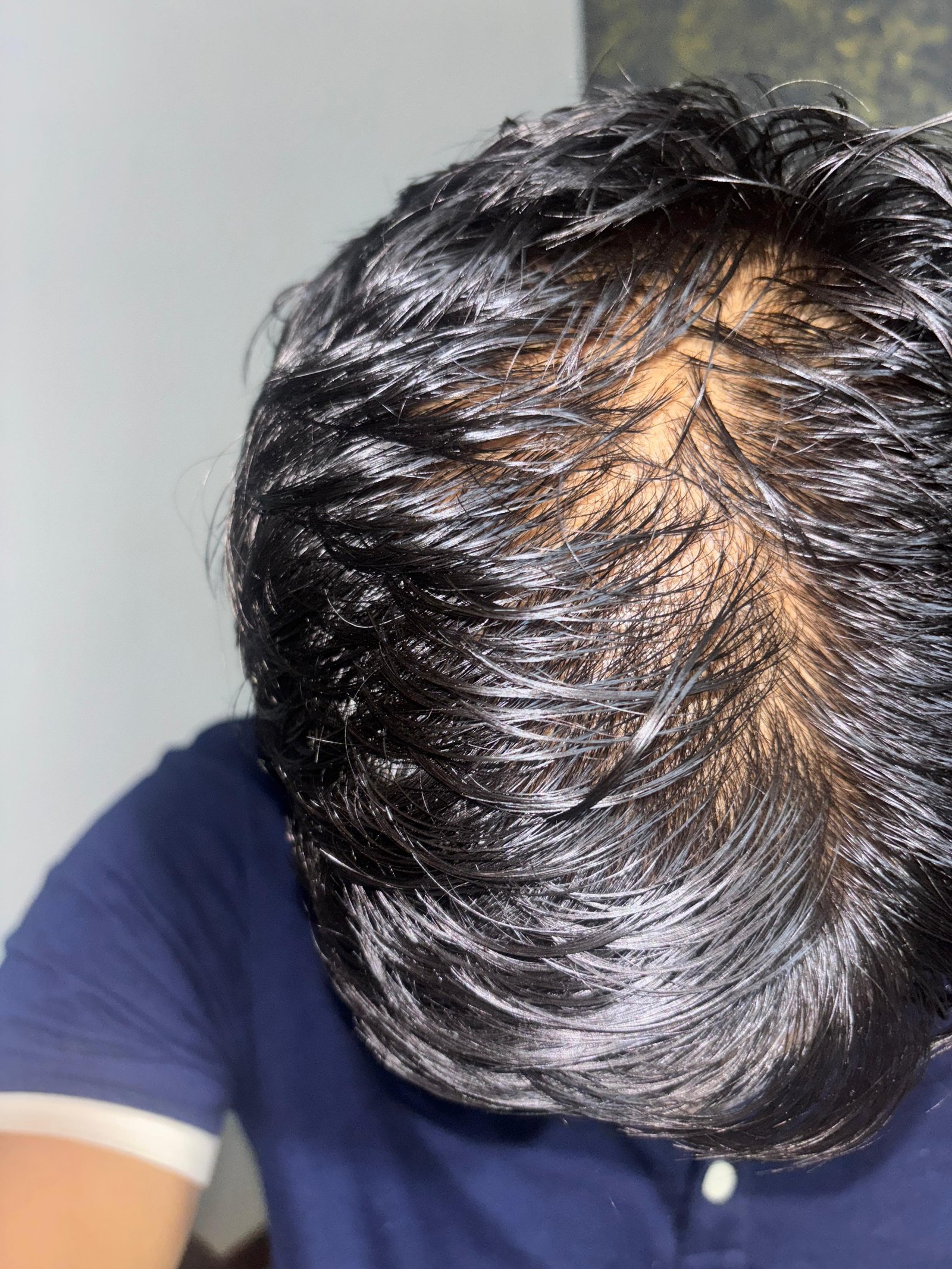 Before