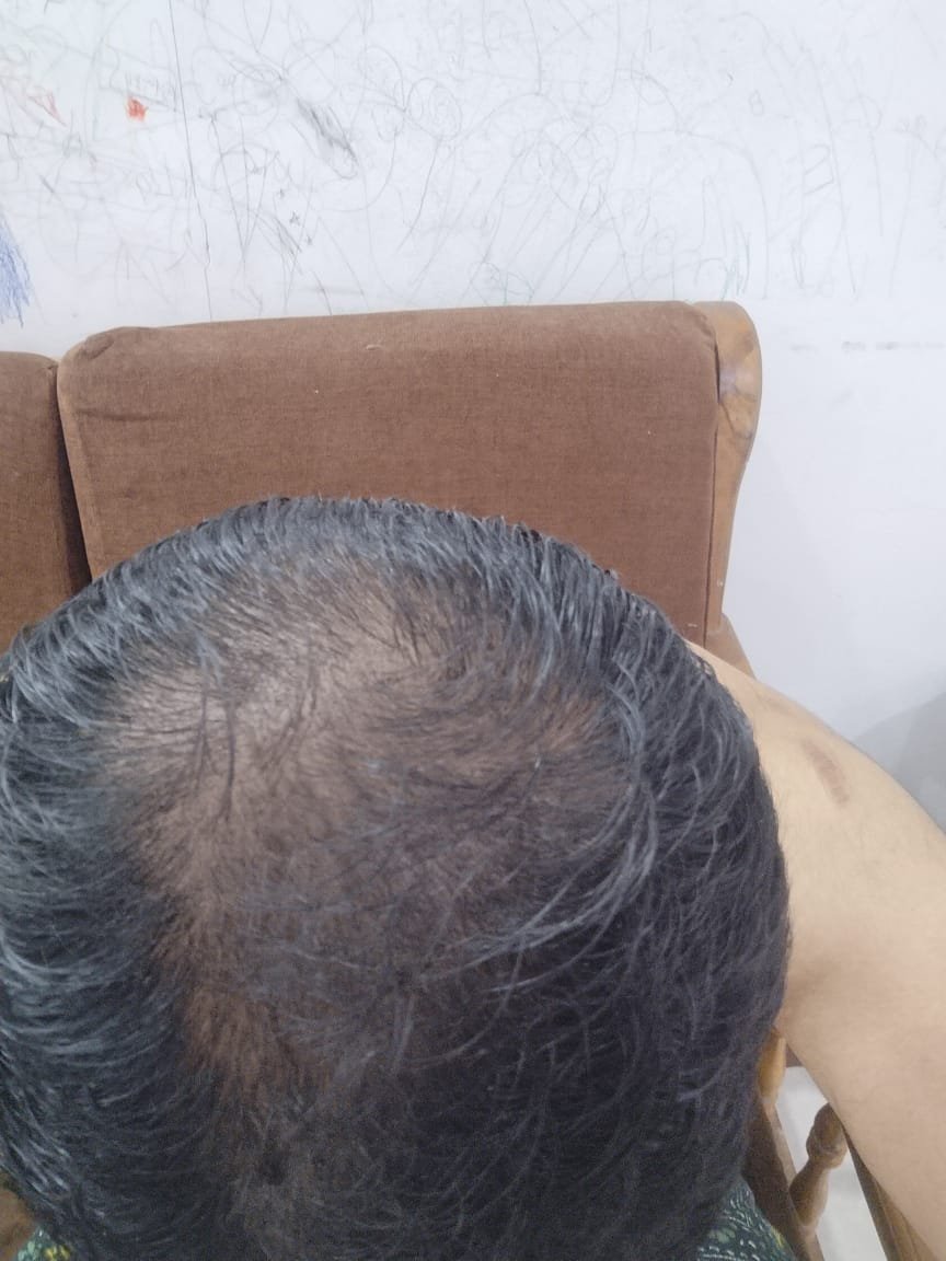 Before