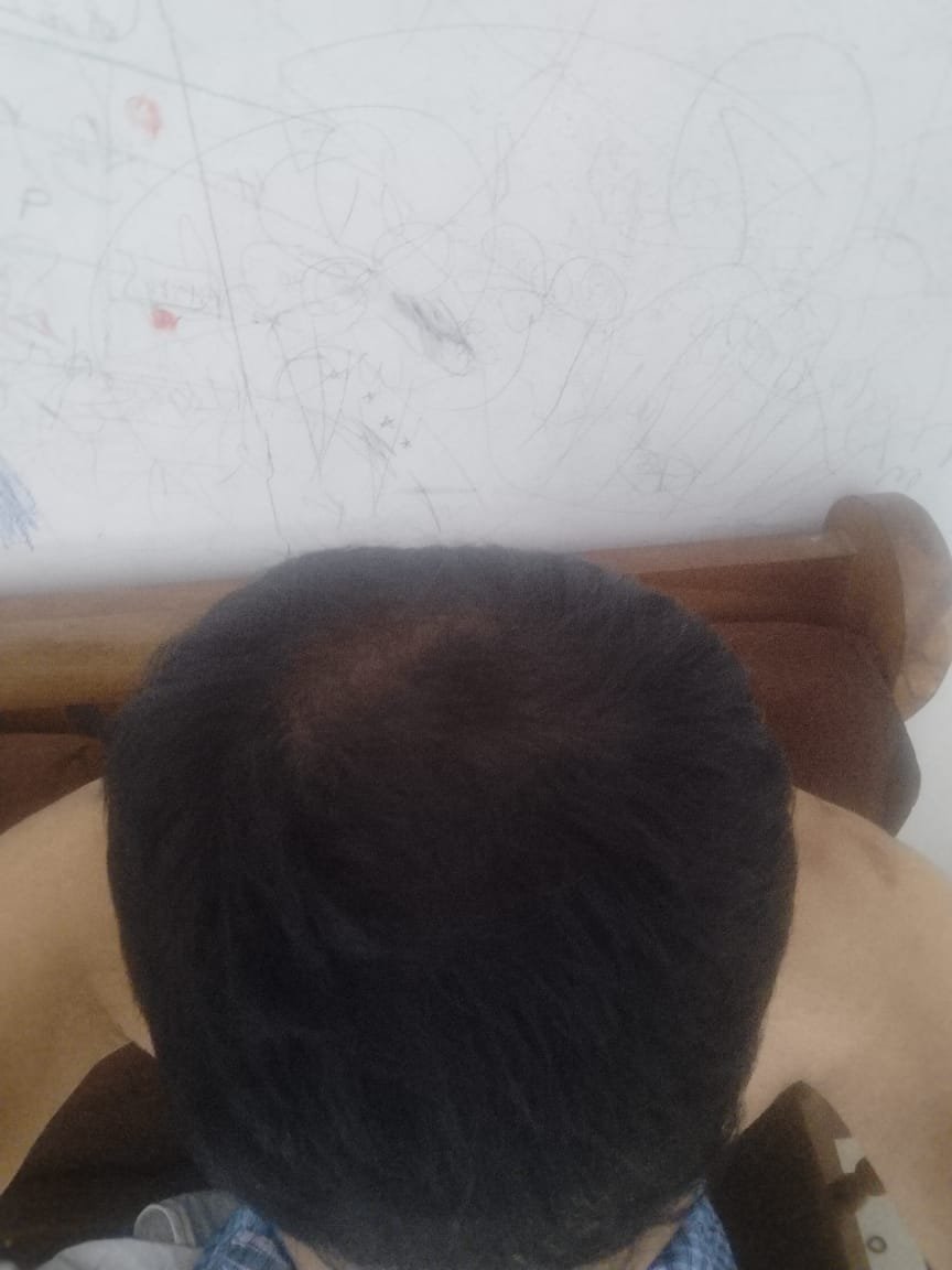 After