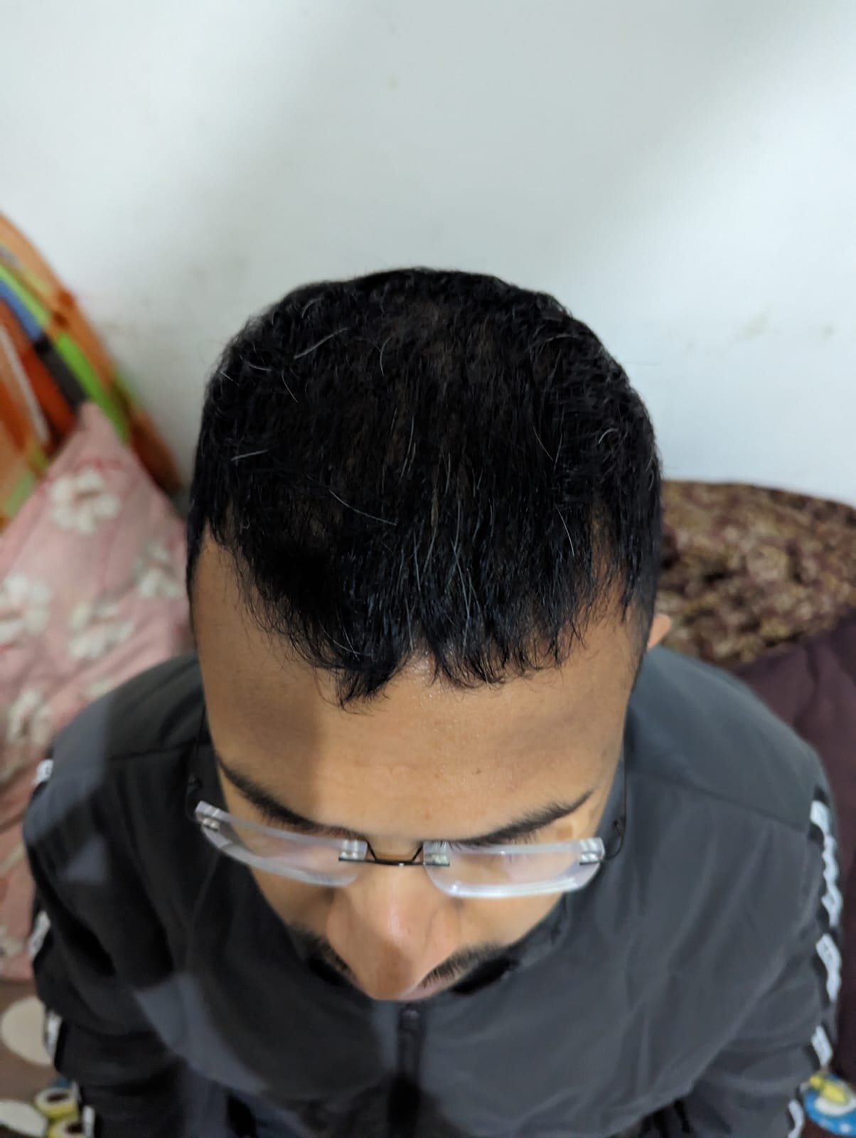 Before