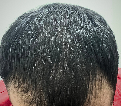 After