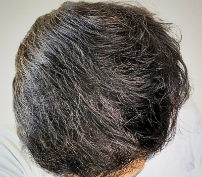 After