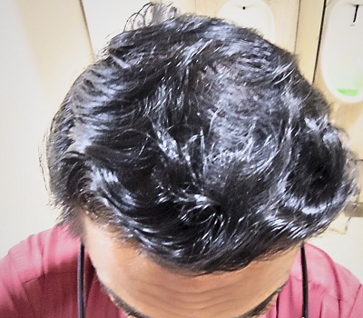 After