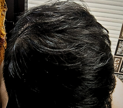 After