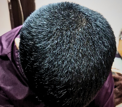 After