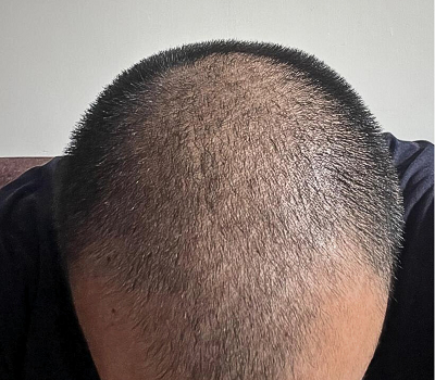 Before