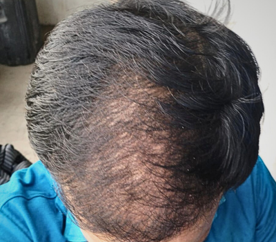 Before