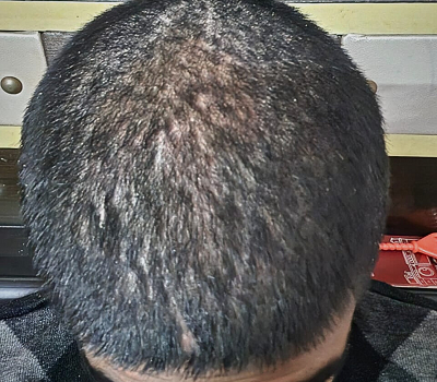 Before