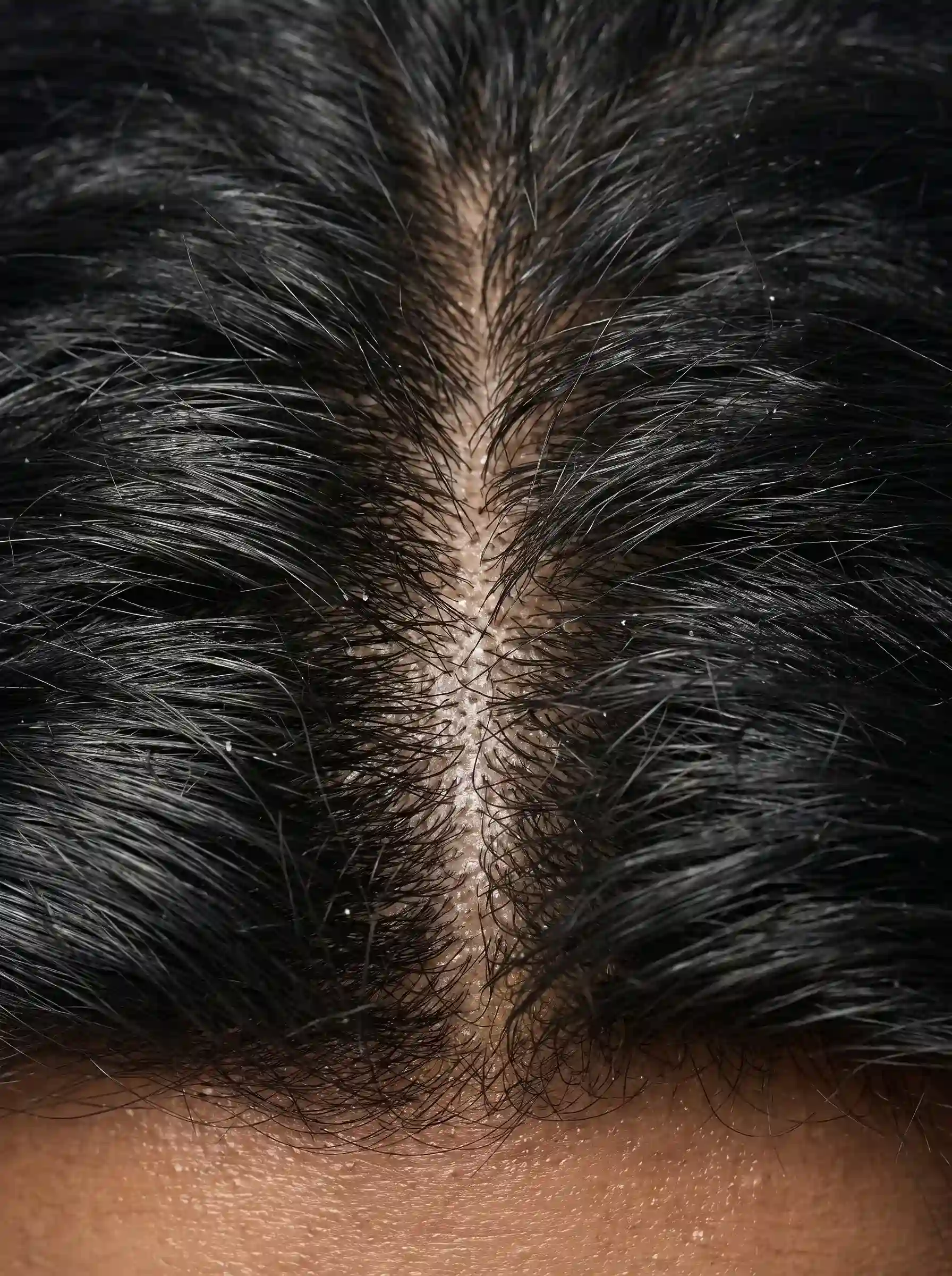 Zoomed Hair
